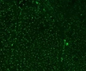 Nucleoli Marker Antibody [NM95]