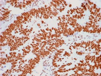 Nucleoli Marker Antibody [NM95]