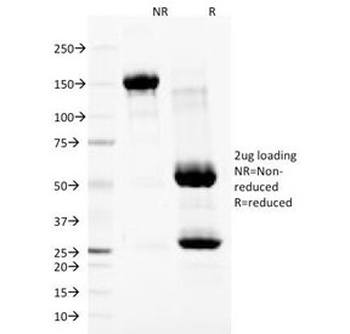Nuclear Membrane Marker Antibody [NM97]