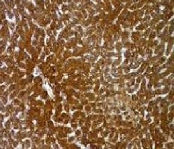 Hep Par 1 Antibody [OCH1E5]