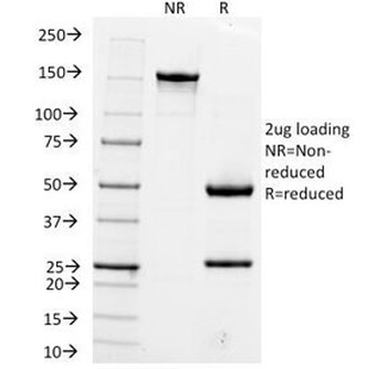 Hep Par 1 Antibody [OCH1E5]