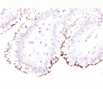 Helicobacter Pylori Antibody