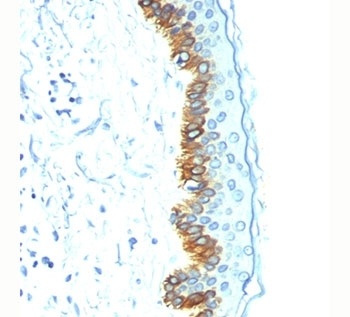 KRT10 Antibody