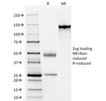 Acidic Cytokeratin Antibody [AE1]