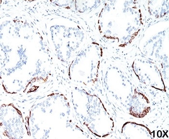 KRT1 Antibody