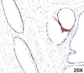 KRT1 Antibody