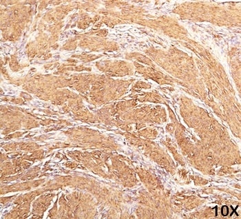 ACTA1 Antibody