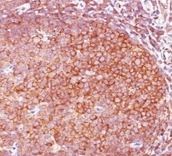 Bcl10 Antibody [BL10/411]