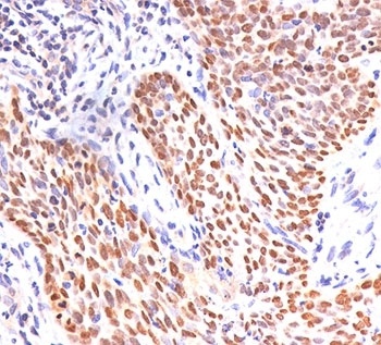 p40 Antibody