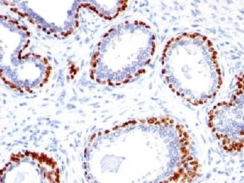 TP63 Antibody