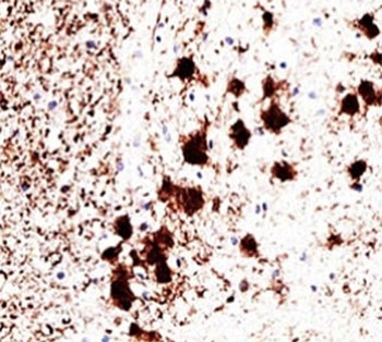 UCHL1 Antibody