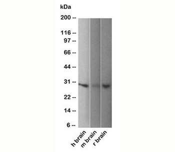 UCHL1 Antibody