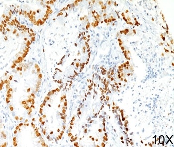 NKX2-1 Antibody
