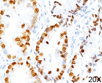 NKX2-1 Antibody
