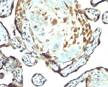 TIMP3 Antibody