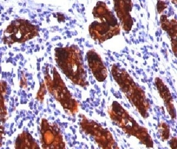 TG Antibody