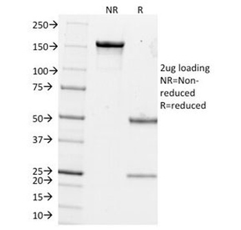 Estrogen Inducible Protein pS2 Antibody [GE2]