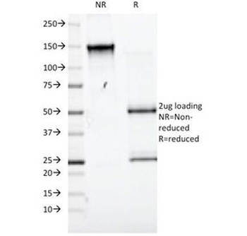 SLC3A2 Antibody [UM7F8]