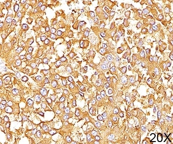 PMEL Antibody