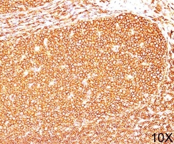PTPRC Antibody