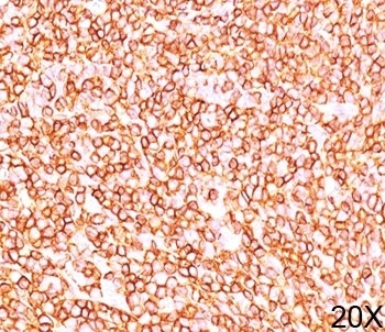 PTPRC Antibody