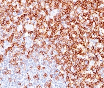 PTPRC Antibody