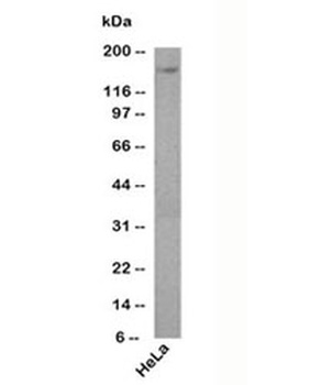PODXL Antibody