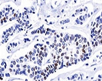 PGR Antibody