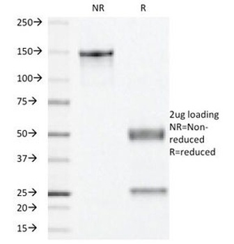 PGR Antibody