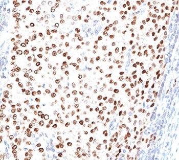 PGR Antibody