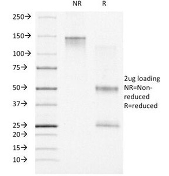 PGR Antibody