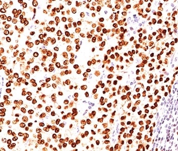 PGR Antibody