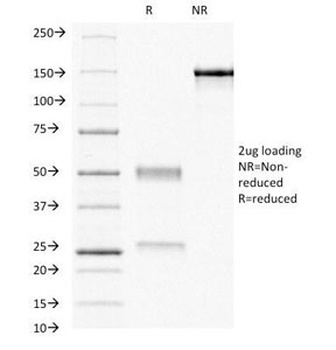 PGR Antibody