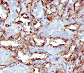 PECAM-1 Antibody [C31.7]