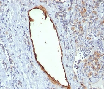 PECAM-1 Antibody [C31.7]
