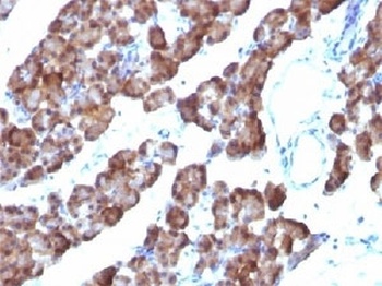ODC1 Antibody