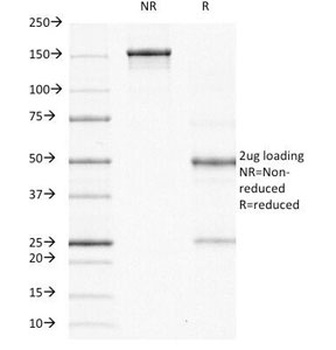 ODC1 Antibody