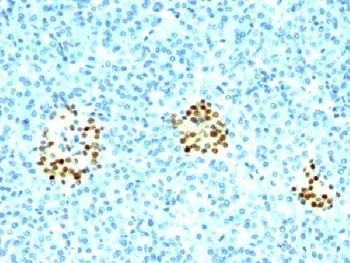 NKX2.2 Antibody [NX2/294]