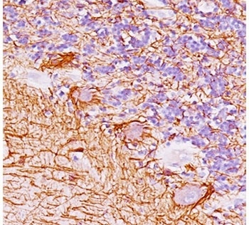 NEFH Antibody