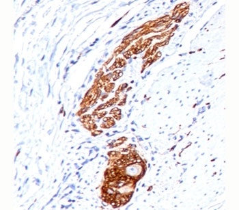 NCAM1 Antibody