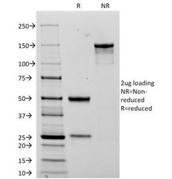 NCAM1 Antibody