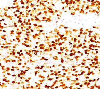 MYOG Antibody