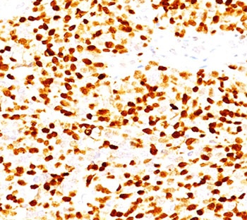 Myogenin Antibody [MGN185]