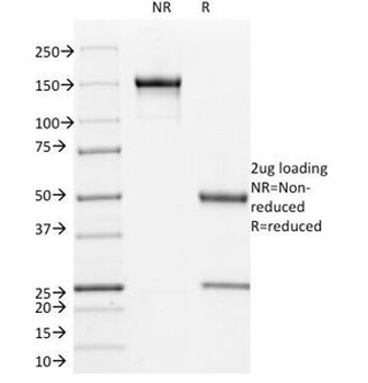 L1CAM Antibody [UJ127]
