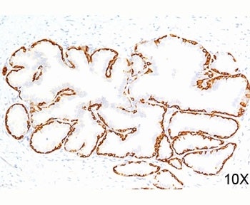 KRT14 Antibody