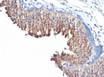KRT10 Antibody