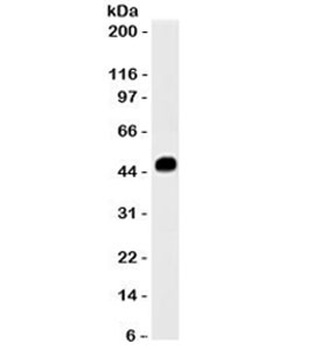 KRT8 Antibody