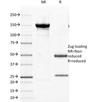KRT8 Antibody