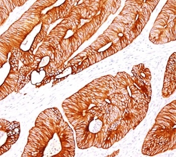KRT8 Antibody