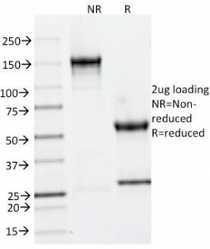Cytokeratin 6 Antibody [LHK6]